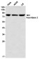 Aconitase 2 Rabbit mAb ABZ1879