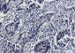 Smad5 Rabbit mAb ABZ1881