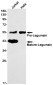 LGMN Rabbit mAb ABZ1885