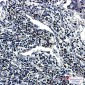 RING2 / RING1B / RNF2 Rabbit mAb ABZ1888