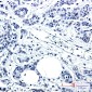 PNKP Rabbit mAb ABZ1894