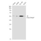 PNKP Rabbit mAb ABZ1894