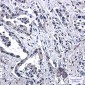 VPS35 Rabbit mAb ABZ1901