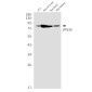 VPS35 Rabbit mAb ABZ1901