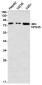 VPS35 Rabbit mAb ABZ1901