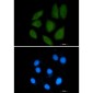 Importin 9 Rabbit mAb ABZ1906
