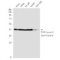 PHD1/prolyl hydroxylase Rabbit mAb ABZ1908