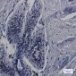 CDK5RAP3 Rabbit mAb ABZ1911