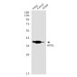 HPDL Rabbit mAb ABZ1914