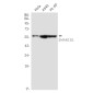 SMARCD1 Rabbit mAb ABZ1916