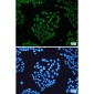 THOC1 Rabbit mAb ABZ1919