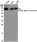 THOC1 Rabbit mAb ABZ1919
