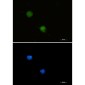 FUBP1/FBP Rabbit mAb ABZ1927