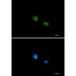 FUBP1/FBP Rabbit mAb ABZ1928