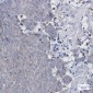 Adipose Triglyceride Lipase Rabbit mAb ABZ1929