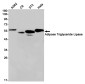 Adipose Triglyceride Lipase Rabbit mAb ABZ1929