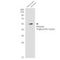 Adipose Triglyceride Lipase Rabbit mAb ABZ1930