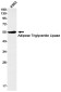 Adipose Triglyceride Lipase Rabbit mAb ABZ1930