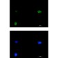 SMARCC1/BAF155 Rabbit mAb ABZ1940