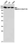 SMARCC1/BAF155 Rabbit mAb ABZ1940