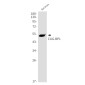CUG BP1 Rabbit mAb ABZ1943