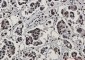 Rad50 Rabbit mAb ABZ1944