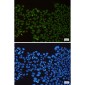 HDAC2 Rabbit mAb ABZ1953