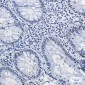 HDAC2 Rabbit mAb ABZ1953