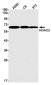 HDAC2 Rabbit mAb ABZ1953