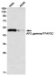 AP2 gamma/TFAP2C Rabbit mAb ABZ1955