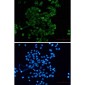 Nectin 2 Rabbit mAb ABZ1957