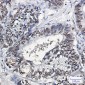 PHAPI2 Rabbit mAb ABZ1958