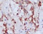 PI3 Kinase p55 gamma Rabbit mAb ABZ1962