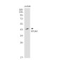 ATG4A Rabbit mAb ABZ1969
