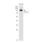 CD276 Rabbit mAb ABZ1978