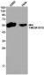 Transmembrane Protein 161B Rabbit mAb ABZ1987