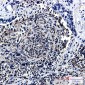 HJURP Rabbit mAb ABZ1988