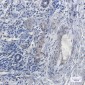 SCAI Rabbit mAb ABZ1992