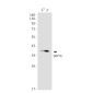 SIRT6 Rabbit mAb ABZ1993