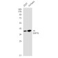 SIRT6 Rabbit mAb ABZ1993