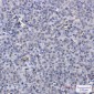 PELP1 Rabbit mAb ABZ1996