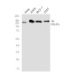 PELP1 Rabbit mAb ABZ1996