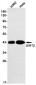 SIRT2 Rabbit mAb ABZ1999
