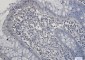 SIRT2 Rabbit mAb ABZ2000
