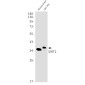 SIRT2 Rabbit mAb ABZ2000