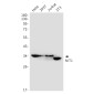 NIT1 Rabbit mAb ABZ2006