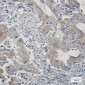 TAX1BP1 Rabbit mAb ABZ2008