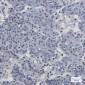 PABPN1 Rabbit mAb ABZ2013