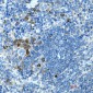 CD272/BTLA Rabbit mAb ABZ2016