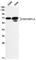CD272/BTLA Rabbit mAb ABZ2016